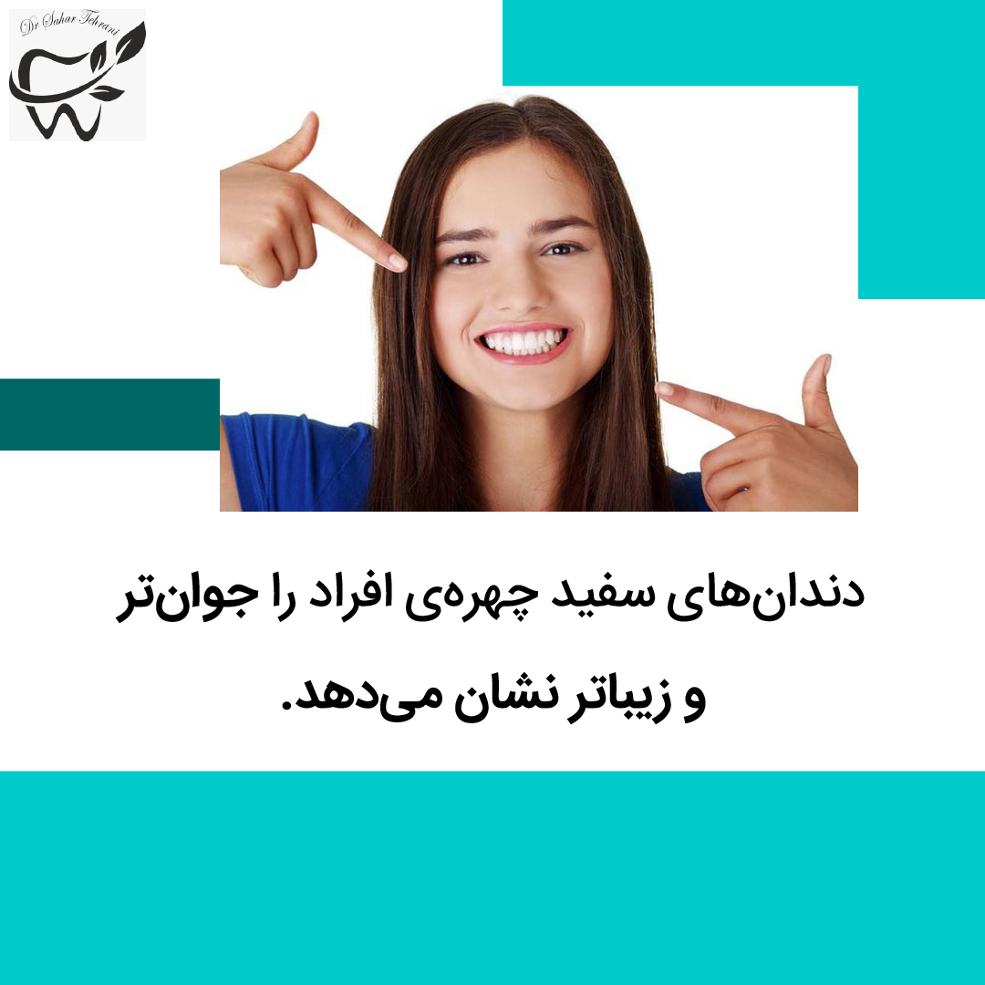 مزایای بلیچینگ، دکتر سحر طهرانی، دندانپزشک عمومی، تهران