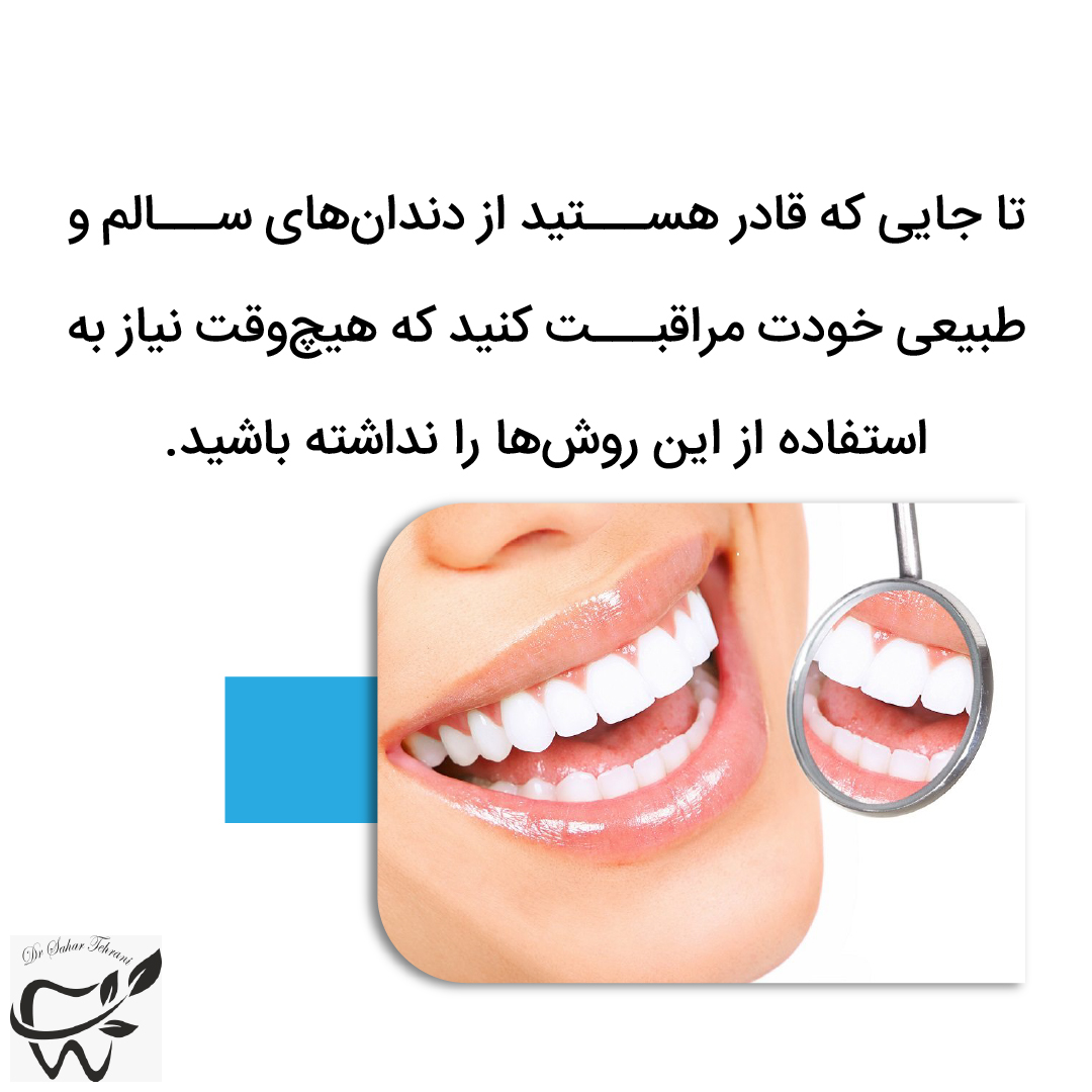 عفونت ایمپلنت دندان، دکتر سحر طهرانی، تهران